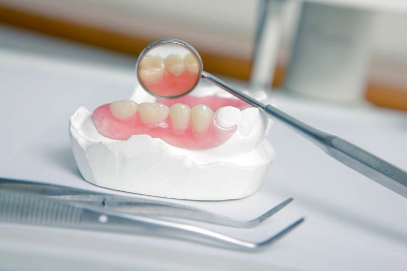 prostodoncia en Clínica Dental Tramvia